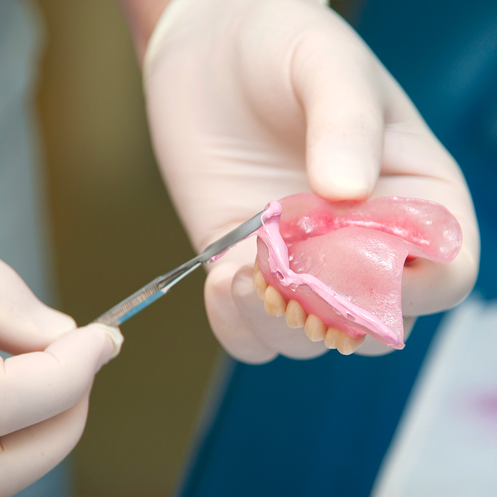  Auslöser für Druckstellen im Mund können beispielsweise Zahnprothesen sein. Ein Zahnarzt zeigt eine Prothese.