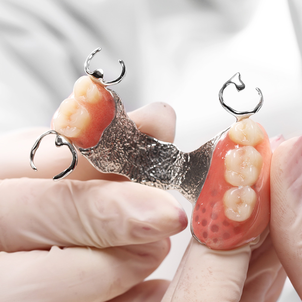  Auslöser für Druckstellen im Mund können beispielsweise Zahnprothesen sein. Ein Zahnarzt zeigt eine Teilprothese.